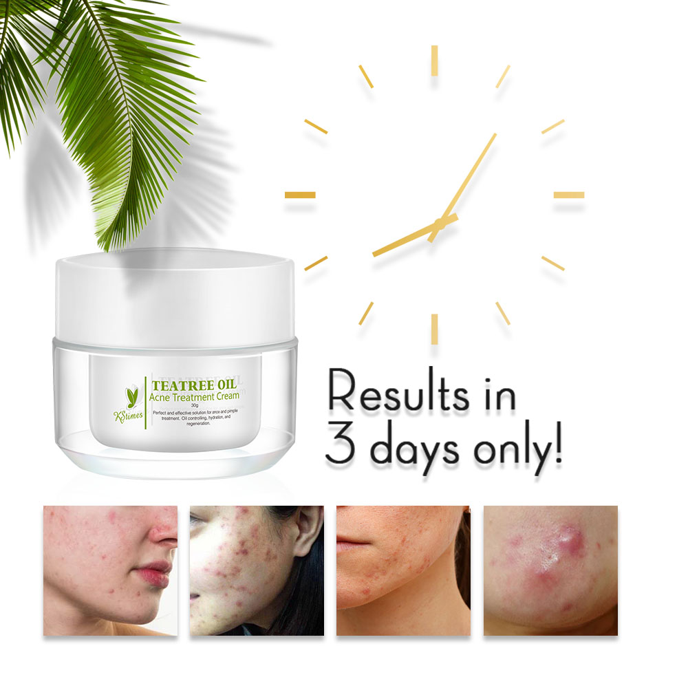 KStims Natural Acne Treatment  - Tea Tree Spot Treatment บทวิจารณ์และราคา
